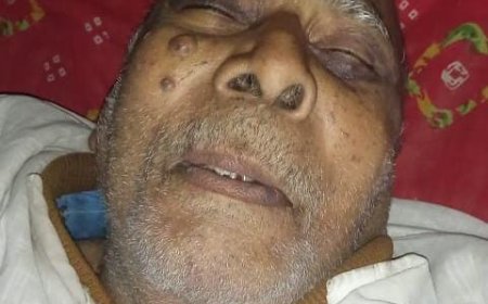 आलापुर में शोकसभा का हुआ आयोजन,